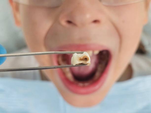 Best Pediatric Emergency Dentist in Grosse Pointe Park, MI